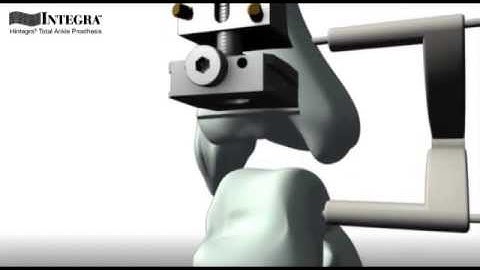 Integra Prosthesis 1