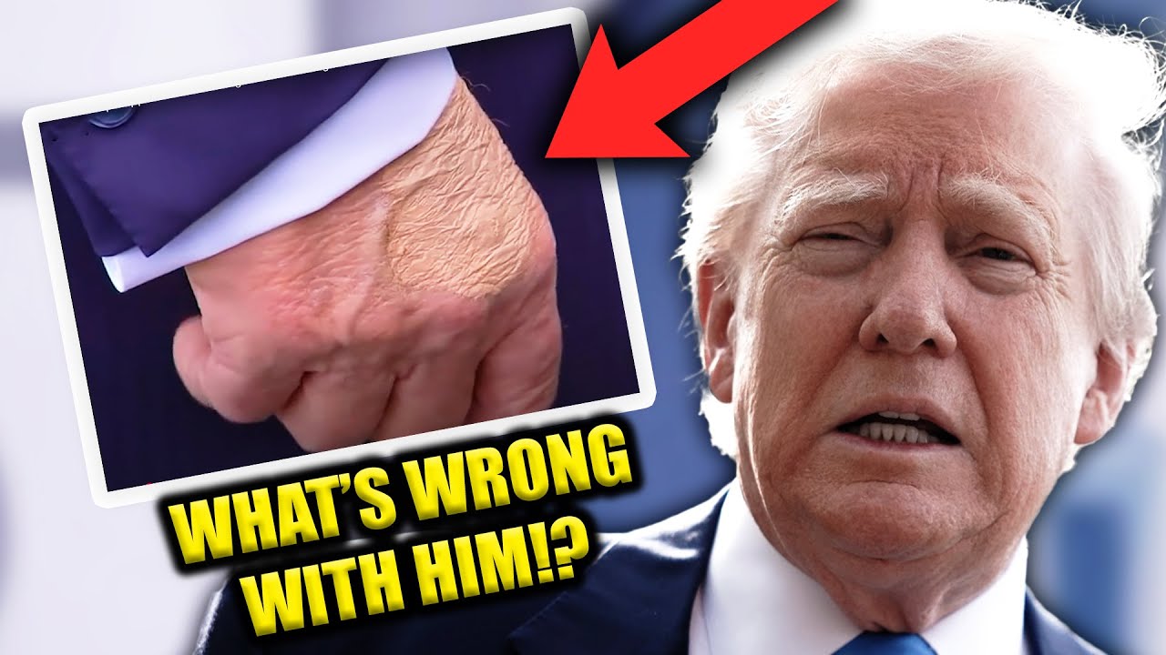 Trump’s Health Is Becoming Harder to Ignore...