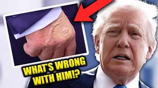 Trump’s Health Is Becoming Harder to Ignore...