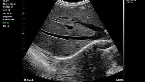 128 elements white&black convex C10RN