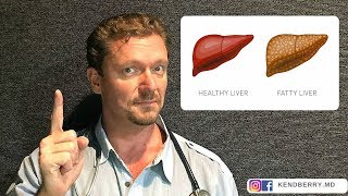 ❗ STOP These 5 Things to Reverse Fatty Liver (Update 2024) ❗