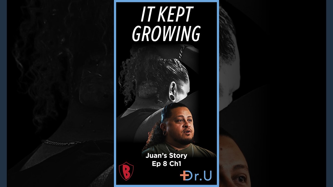 His Son Just Wants to Play. One Touch Makes Him Pull Away.