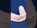 U Ortho Dental Vacuum Forming Machine | Precise Molding for Orthodontic Appliances
