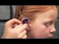 Как правильно одеть слуховой аппарат ребенку