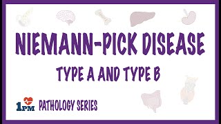 Niemann Pick Disease Type A and Type B - causes, symptoms, diagnosis, treatment, pathology Resimi