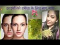 झाइयो को हमेशा के लिए जड़ से खत्म करें |अमरबेल का कमाल |Home made face pack