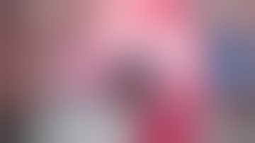 Pupilloplasty / Iridoplasty