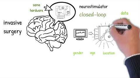 Personalized Closed-loop Neurostimulators for Epilepsy