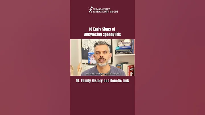 PART 10 | 10 Early Signs of Ankylosing Spondylitis You Shouldn’t Ignore!