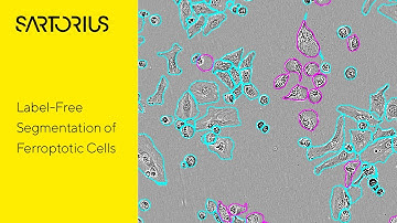 Multifaceted Characterization of Ferroptosis using Live-Cell Imaging and AI-driven Analysis