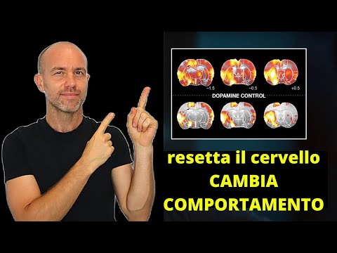 Dopamina: il segreto per fare le cose difficili