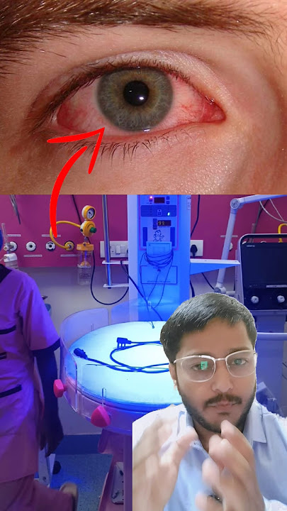 conjectivitis// Eye Flu, #eyeflu #shorts #doctor #mbbs