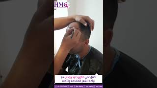 احصل على مظهر جديد وجذاب مع زراعة الشعر بالتقنيات الحديثة . @HMC_Beauty