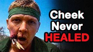 the Most Disturbing Survivor Show Accidents Iceberg