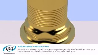 IPD dental interface system