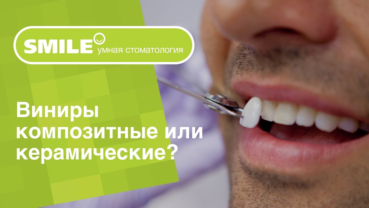 🤷♀️ В чем разница между керамическими и композитными винирами?