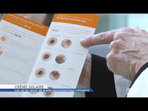 Vidéo: Symptômes Du Cancer De La Peau: Images, Types Et Plus