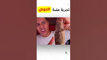 هو البرص سام ولا لا Shorts 