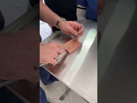 Continuous Suture: involve a series a stitches to improve your surgery signature.