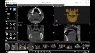 Lesson 1: CS 3D Software Interface Introduction