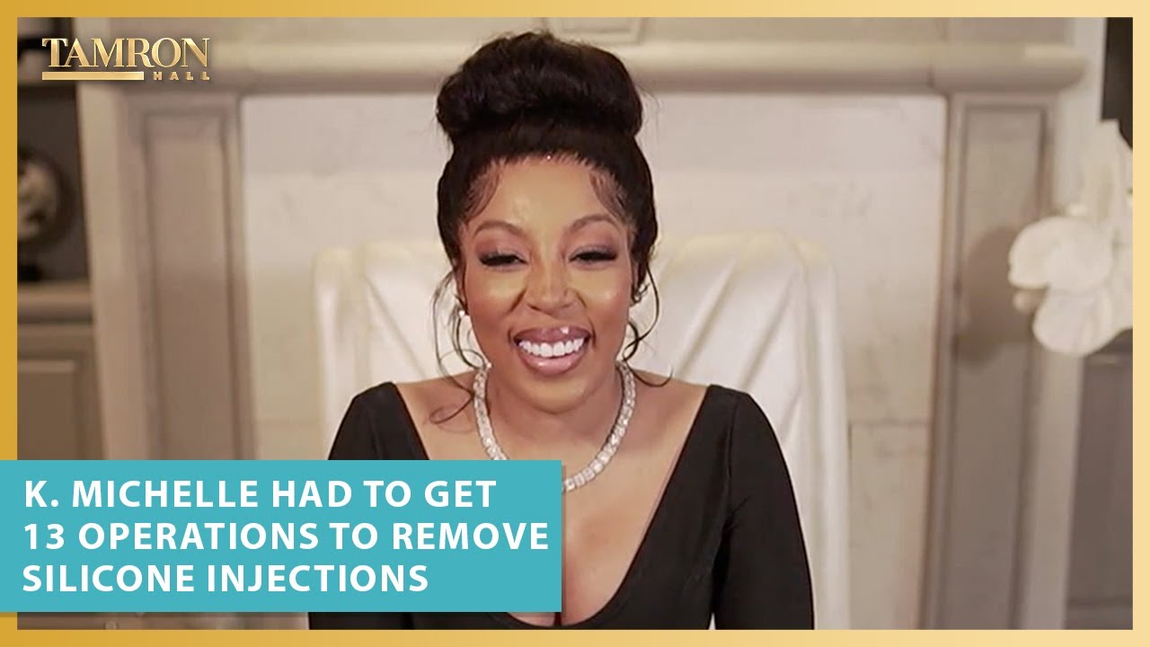 K. Michelle Had To Get 13 Operations To Remove Botched Silicone Injections