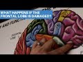 What Happens If The Frontal Lobe Is Damaged?