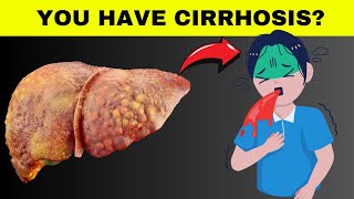 Five Signs Of Liver Cirrhosis That You Shouldn