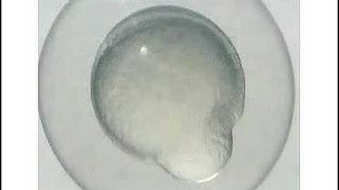 Zebrafish development timelapse