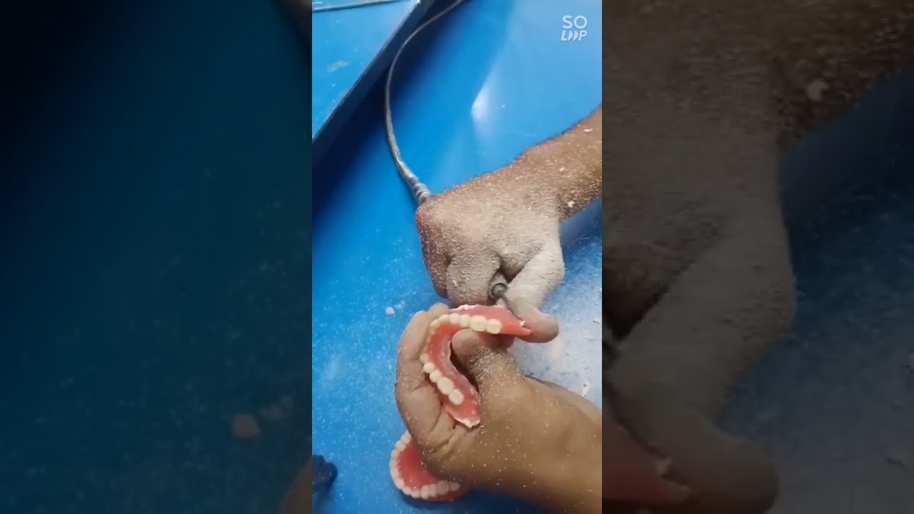 complete denture relining