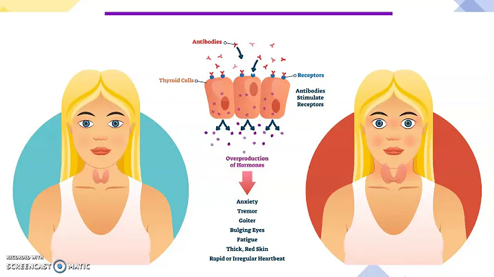 Thyroid Disease and Diabetes