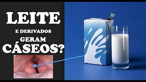 O que não comer quando está com amigdalite?