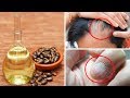 9 Amazing Things Castor Oil Can Do To Your Body Castor oil is extracted from the seeds of the ricinus communis plant, and is not toxic, as most people think, because the toxic substance in the plant, ricin, is not soluble in oil.
It has been around for a long time and has been widely used for medicinal purposes.
It is one of many vegetable oils that has been used industrially for both therapeutic uses and cosmetic ones.
Thus, the main benefits of using castor oil are:
For our hair
For our nails
For our skin
In addition to these cosmetic benefits, castor oil can be used medicinally:
As a natural laxative
To relieve muscle and joint pain
Now that you know about these benefits, you need to know how to use castor oil.
Before using castor oil for any of these treatments, it is recommended that you perform an allergy test to make sure that you don’t react negatively.
Apply a small amount of oil to your arm, and wait 24 hours. If there is no redness, itching, blistering, peeling, or any other signs, the product may be used. If not, discontinue use.
Its use is not recommended for pregnant women, infants, children and patients suffering from bowel obstruction, inflammatory bowel diseases and any other intestinal disease (known or suspected.)
In addition, it should not be applied on mucous membranes such as mouth, eyes and ears.
----------------------------------------
▶ Subscribe to the channel - https://goo.gl/3tB19z
▶ Natural Cures en español - https://goo.gl/QcoLf2
▶ नेचर क्योर्स - Natural Cures (Hindi) - https://goo.gl/okYDFd
▶ Mindfully Yours - https://goo.gl/qXiBjy
Disclaimer: The materials and the information contained on Natural Cures channel are provided for general and educational purposes only and do not constitute any legal, medical or other professional advice on any subject matter. These statements have not been evaluated by the FDA and are not intended to diagnose, treat or cure any disease. Always seek the advice of your physician or other qualified health provider prior to starting any new diet or treatment and with any questions you may have regarding a medical condition. If you have or suspect that you have a medical problem, promptly contact your health care provider.