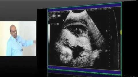 NEETPG Image based MCQ Mock Test Discussion 1487 Lec 01