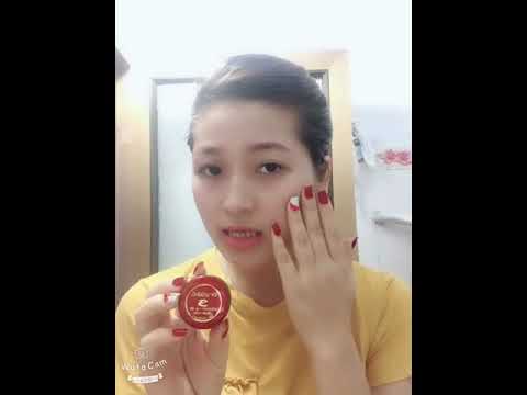 Tri nám tàn nhang trị tận gốc nám da, tàn nhang nhanh nhất - 0985123191 -