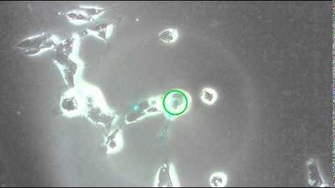 Acquistion of Single GFP SH-SY5Y using Fluorescence Compatible KuiqpicK
