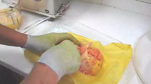 Citrus ginger juice made on a Whole Health Foundation juicer a Norwalk juicer alternative