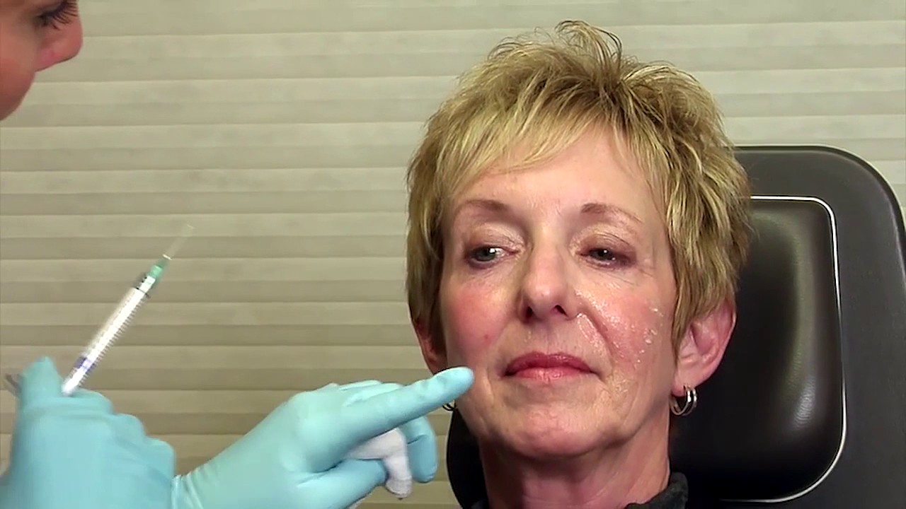 Qualifications of a Nurse Injector Louis P. Bucky, MD Philadelphia