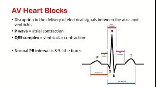 AV Heart Blocks: Easy story + mnemonic!
