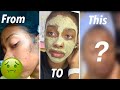 **My Skin Went From That , To THIS in 1 Week* |Aztec Clay Mask 1 Week Challenge!!