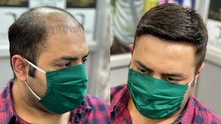 Hair Patches For Men | Hair Transformation | Hair Wig For Men | Natural Hair line | 9650914665