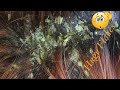 Satisfying Dandruff Removal Big Flakes | Dandruff Scratching Psoriasis (sample dandruff)