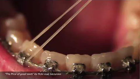 Judith Garber - Orthodontics in American culture