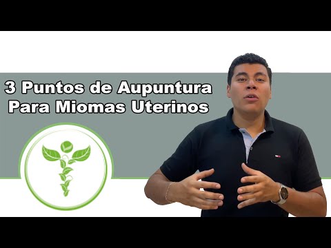 3 Puntos de acupuntura para eliminar Miomas Uterinos