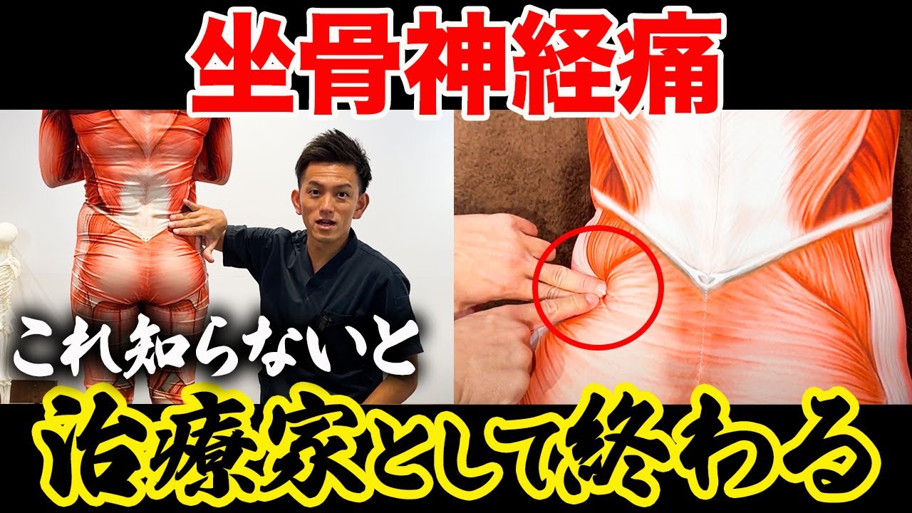 【※開業した整体師必見】坐骨神経痛について理解できている？治療の落とし穴を教えます！