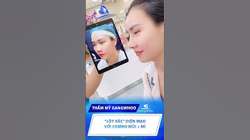 "Lột Xác" Diện Mạo Với Combo Nâng Mũi & Cắt Mí #shortvideo #shorts #short