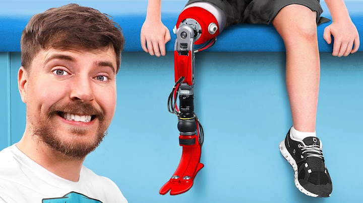 We Helped 2000 People Get New Legs