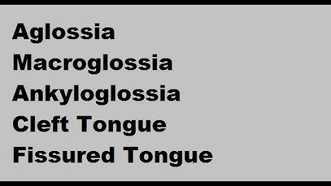 Developmental disorders of Tongue : Part 1