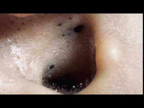 Satisfying video with Chung Vo Spa #115