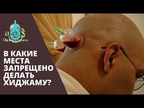 В какие места запрещено делать хиджаму?