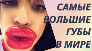 💋Девушки, которые переборщили с филлерами. Как выглядят самые большие губы в мире😱